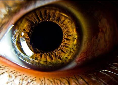 黄斑病变怎么治疗_眼睛黄斑病变应该如何治疗